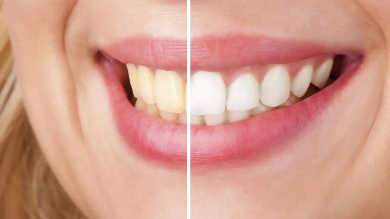 Purchase teeth whitening powder to achieve brighter teeth
